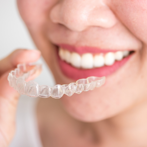Clear Aligners  